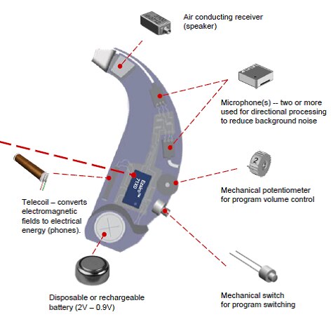 Typical Componets of a BTE Hearing Aid